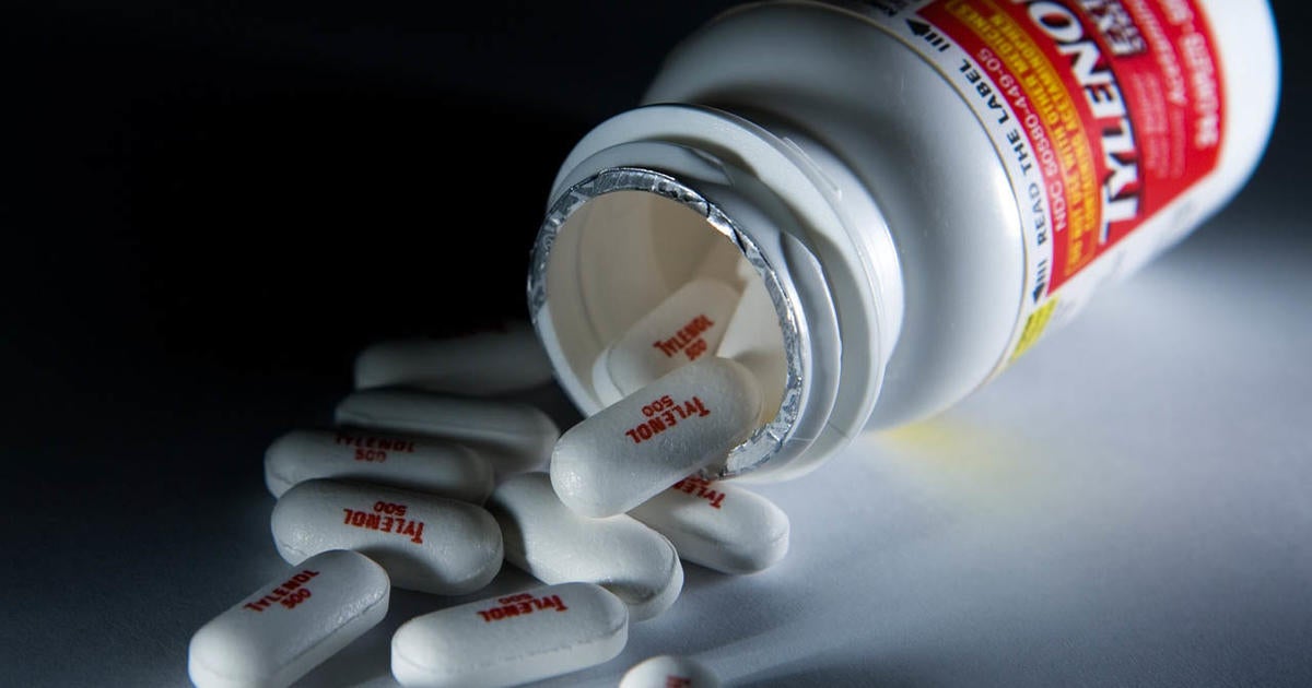 Acetaminophen use during pregnancy linked with language delays